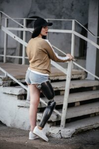 Uma Bela Garota Com Uma Perna Prostética, Sentada Em Um Banco, Exalando Confiança E Força.